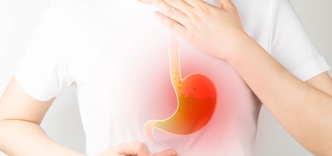 Bruciore di stomaco: cause e rimedi