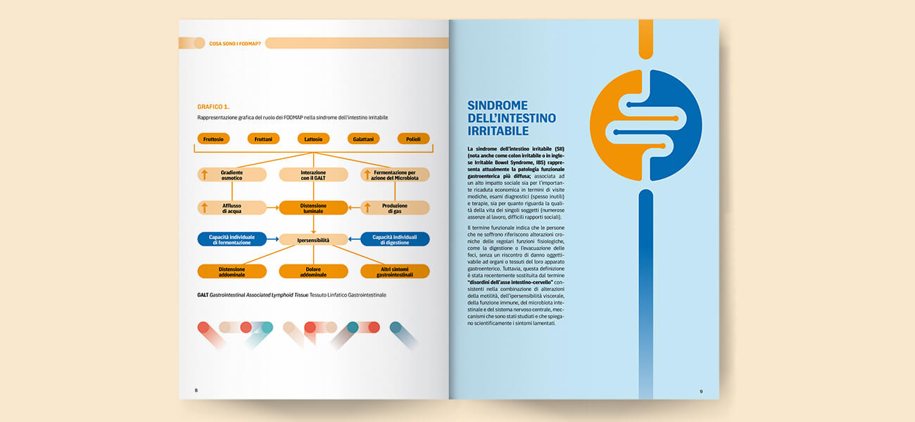 Sindrome dell'intestino irritabile